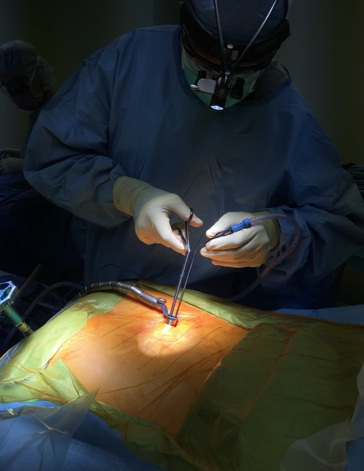 El Dr. Jimenez en el quirófano, con bata y mascarilla, lupas quirúrgicas y lámpara frontal, trabajando con instrumentos sobre un paciente cubierto. El paciente está completamente cubierto y no se le puede identificar.